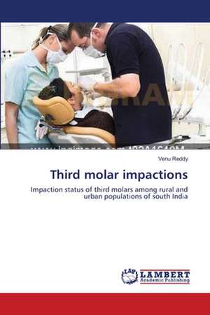 Third molar impactions de Venu Reddy