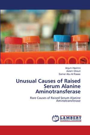 Unusual Causes of Raised Serum Alanine Aminotransferase de Anjum Hashmi