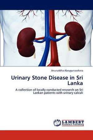 Urinary Stone Disease in Sri Lanka de Anuruddha Abeygunasekera