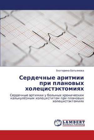 Serdechnye aritmii pri planovykh kholetsistektomiyakh de Bat'yanova Ekaterina
