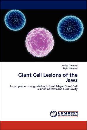 Giant Cell Lesions of the Jaws de Jessica Garewal