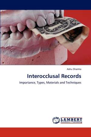 Interocclusal Records de Sharma Ashu