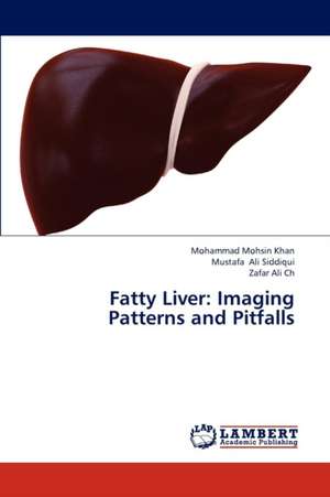 Fatty Liver: Imaging Patterns and Pitfalls de Mohammad Mohsin Khan