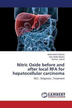 Nitric Oxide before and after local RFA for hepatocellular carcinoma de Abd El Moety Hoda