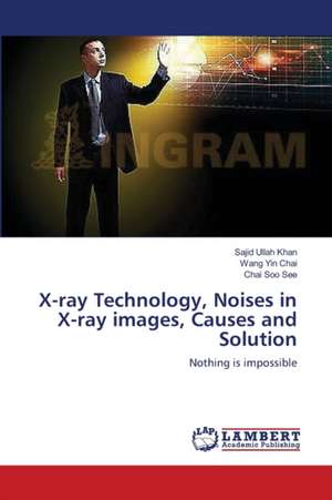 X-ray Technology, Noises in X-ray images, Causes and Solution de Khan Sajid Ullah