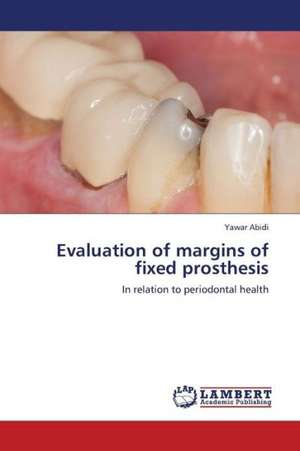 Evaluation of margins of fixed prosthesis de Abidi Yawar