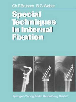 Special Techniques in Internal Fixation de C. F. Brunner