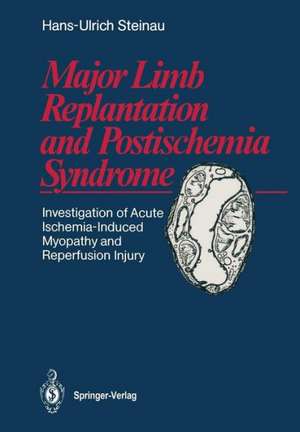 Major Limb Replantation and Postischemia Syndrome: Investigation of Acute Ischemia-Induced Myopathy and Reperfusion Injury de Hans-Ulrich Steinau