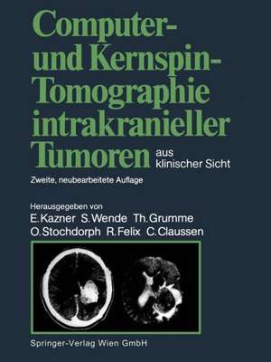 Computer- und Kernspin-Tomographie intrakranieller Tumoren aus klinischer Sicht de Ekkehard Kazner