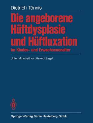 Die angeborene Hüftdysplasie und Hüftluxation im Kindes- und Erwachsenenalter: Grundlagen, Diagnostik, konservative und operative Behandlung de D. Tönnis