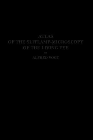 Atlas of the Slitlamp-Microscopy of the Living Eye: Technic and Methods of Examination de Alfred Vogt