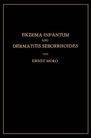 Ekzema Infantum und Dermatitis Seborrhoides: Klinik und Pathogenese de Ernst Moro