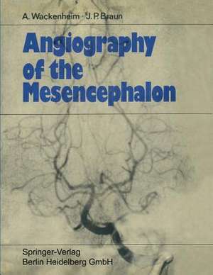 Angiography of the Mesencephalon: Normal and Pathological Findings de Auguste Wackenheim