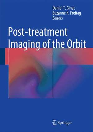 Post-treatment Imaging of the Orbit de Daniel Thomas Ginat