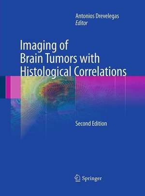 Imaging of Brain Tumors with Histological Correlations de Antonios Drevelegas