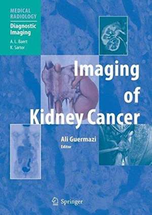 Imaging of Kidney Cancer de Ali Guermazi