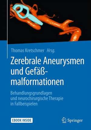 Zerebrale Aneurysmen und Gefäßmalformationen: Behandlungsgrundlagen und neurochirurgische Therapie in Fallbeispielen de Thomas Kretschmer