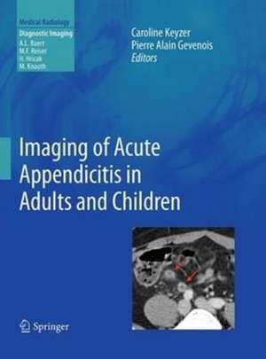 Imaging of Acute Appendicitis in Adults and Children de Caroline KEYZER