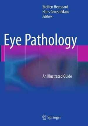 Eye Pathology: An Illustrated Guide de Steffen Heegaard