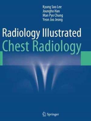 Radiology Illustrated: Chest Radiology de Kyung Soo Lee