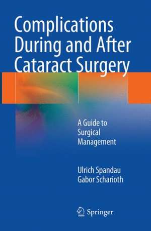 Complications During and After Cataract Surgery: A Guide to Surgical Management de Ulrich Spandau