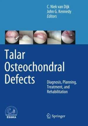 Talar Osteochondral Defects: Diagnosis, Planning, Treatment, and Rehabilitation de C. Niek van Dijk