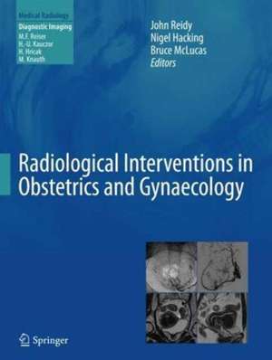 Radiological Interventions in Obstetrics and Gynaecology de John Reidy