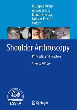 Shoulder Arthroscopy: Principles and Practice de Giuseppe Milano