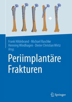 Periimplantäre Frakturen de Frank Hildebrand