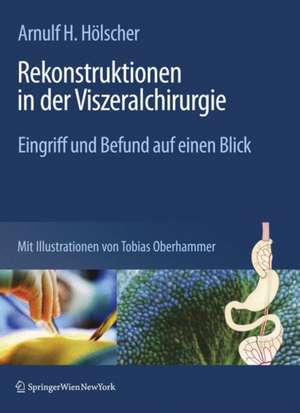 Rekonstruktionen in der Viszeralchirurgie: Schema und Bildgebung de Ulrich Fetzner