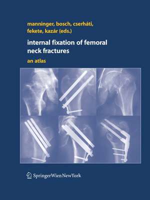 Internal fixation of femoral neck fractures: An Atlas de Jenó Manninger