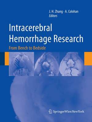 Intracerebral Hemorrhage Research: From Bench to Bedside de John Zhang