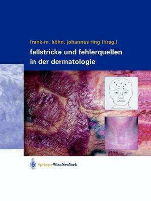 Fallstricke und Fehlerquellen in der Dermatologie de Frank-Michael Köhn