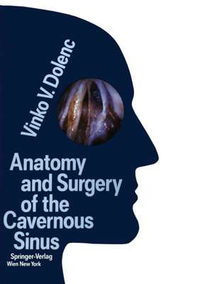 Anatomy and Surgery of the Cavernous Sinus de Vinko V. Dolenc