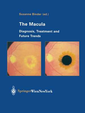 The Macula: Diagnosis, Treatment and Future Trends de Susanne Binder