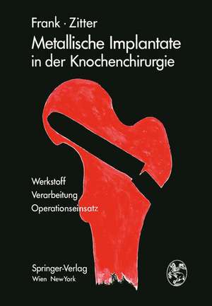 Metallische Implantate in der Knochenchirurgie: Werkstoff · Verarbeitung, Operationseinsatz de Erich Frank