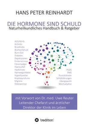 Die Hormone sind schuld! de Hans Peter Reinhardt