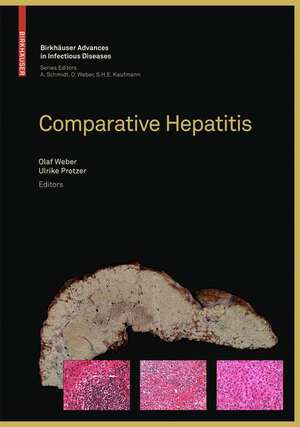 Comparative Hepatitis de Olaf Weber