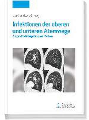 Infektionen der oberen und unteren Atemwege de Santiago Ewig