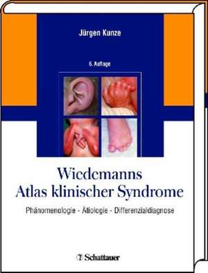 Atlas der Klinischen Syndrome de Hans-Rudolf Wiedemann