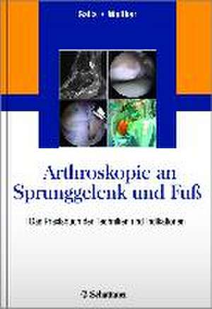 Arthroskopie an Sprunggelenk und Fuß de Mellany Galla