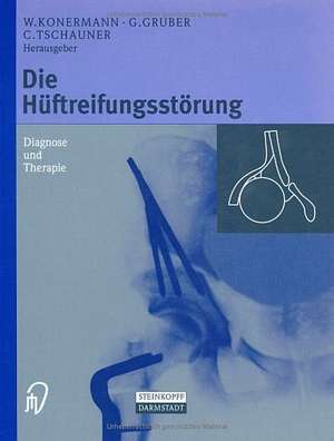 Die Hüftreifungsstörung: Diagnose und Therapie de Werner Konermann