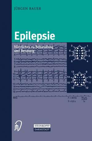 Epilepsie: Nützliches zu Behandlung und Beratung de Jürgen Bauer