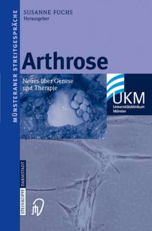 Arthrose: Neues über Genese und Therapie de Susanne Fuchs