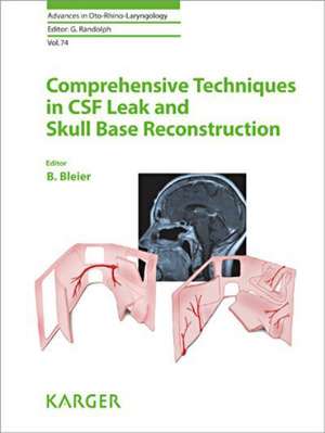 Comprehensive Techniques in CSF Leak Repair and Skull Base Reconstruction de B. S. Bleier