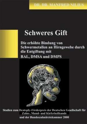 Schweres Gift de Manfred Nilius