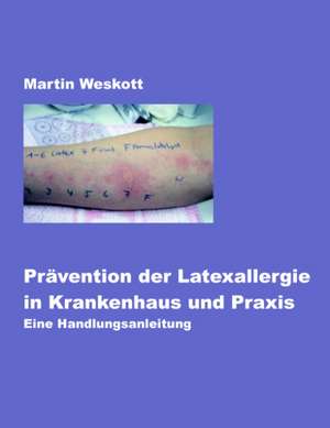 Prävention der Latexallergie in Krankenhaus und Praxis de Martin Weskott