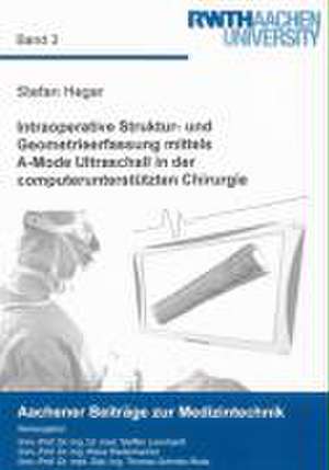 Intraoperative Struktur- und Geometrieerfassung mittels A-Mode Ultraschall in der computerunterstützten Chirurgie de Stefan Heger