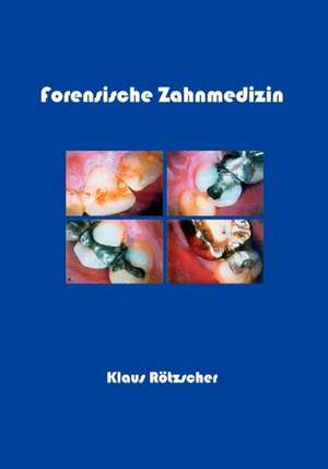 Forensische Zahnmedizin de Klaus Rötzscher