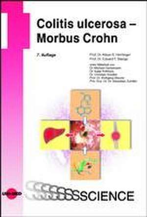 Colitis ulcerosa - Morbus Crohn de Klaus R. Herrlinger